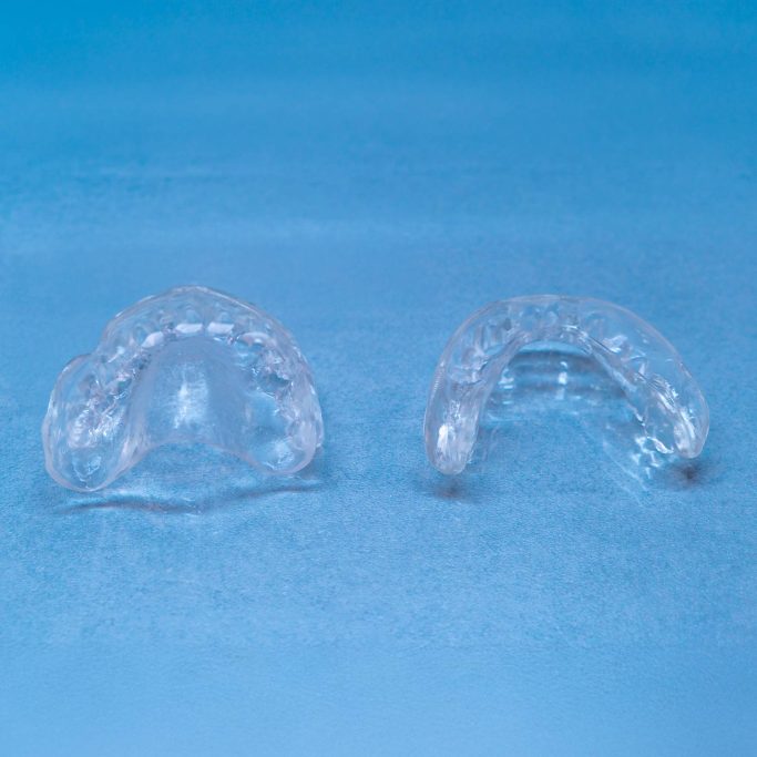 Prothèse adjointe gouttière deplante labs