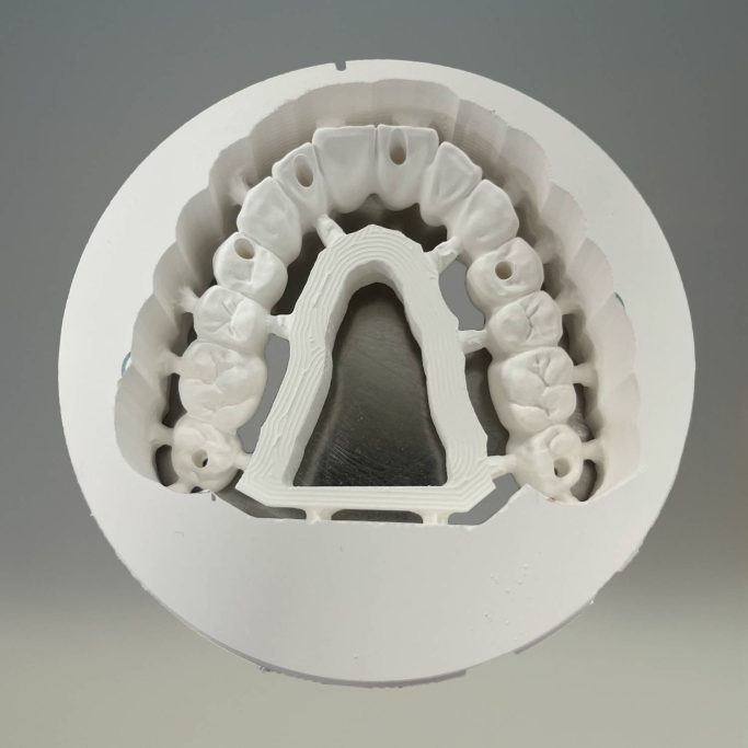 Usinage Complet Zircone