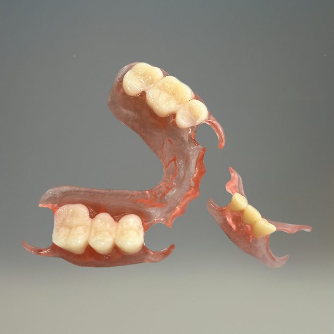 Prothèse adjointe flexible deplante labs