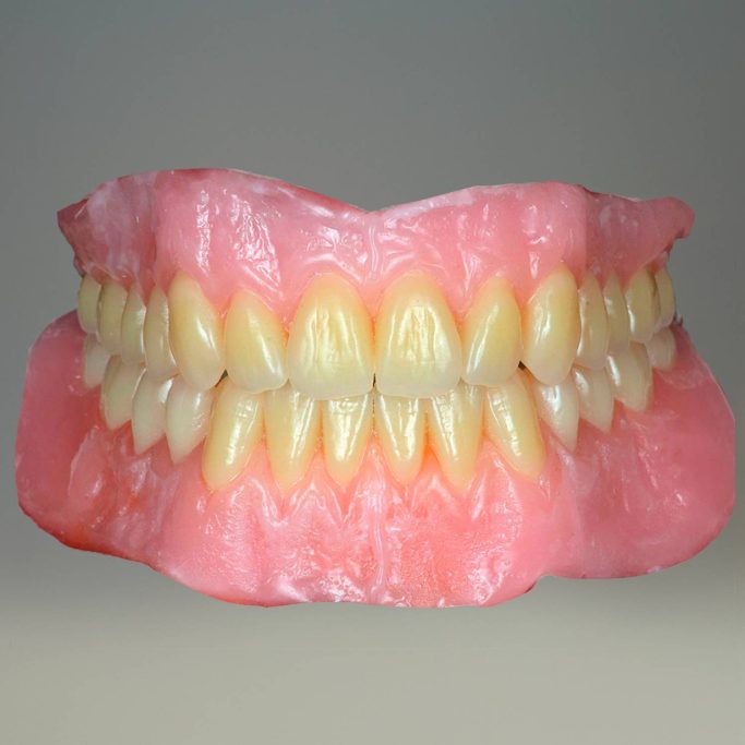 Prothèse adjointe PAC deplante labs